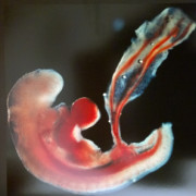 Dinamiche ombelicali prenatali