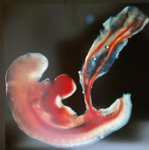 Dinamiche ombelicali prenatali